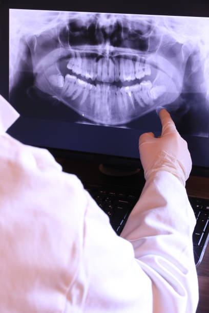 Best Emergency Root Canal Treatment in Rogersville, AL